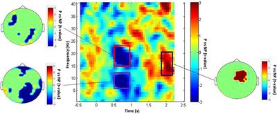 Rhythmic Neural Patterns During Empathy to Vicarious Pain: Beyond the Affective-Cognitive Empathy Dichotomy